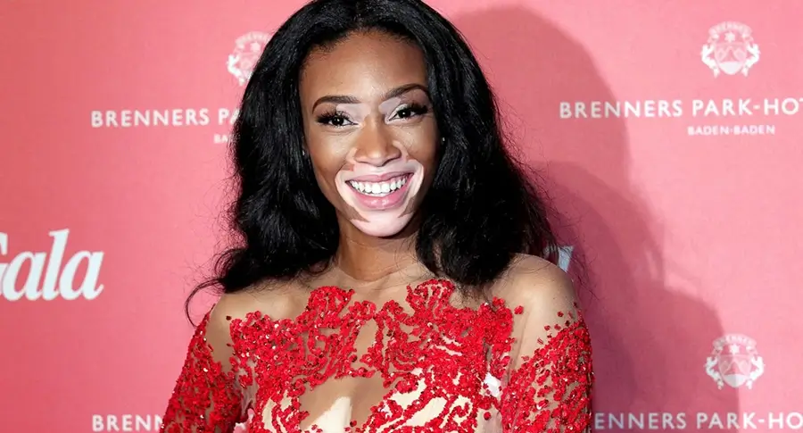 Winnie Harlow